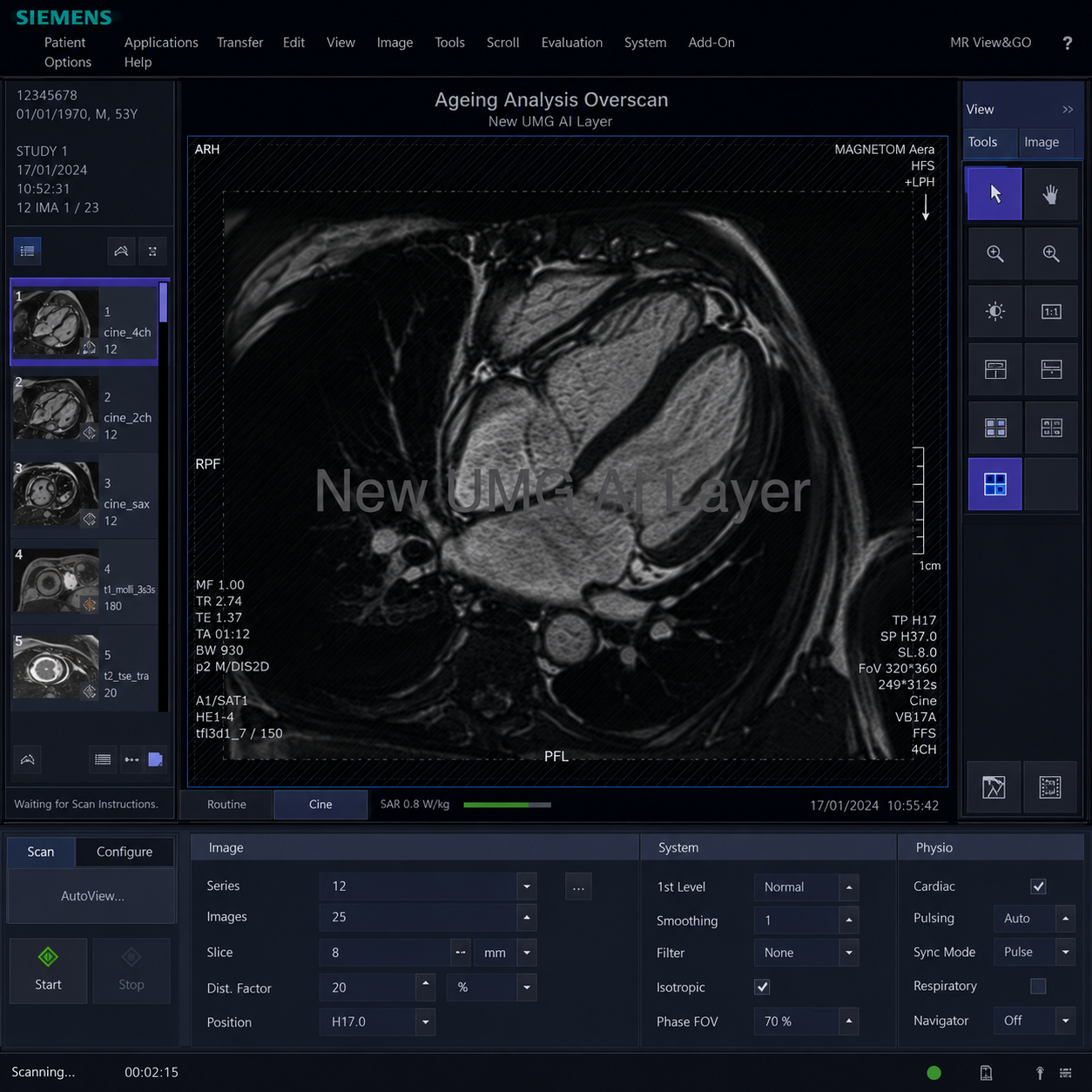 New UMG AI layer interface for organ-ageing analysis